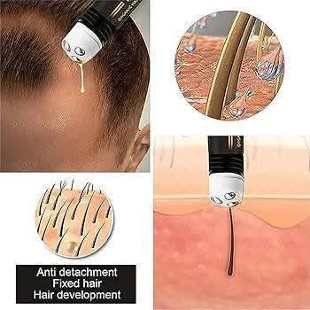 Regrowth Organic Hair Serum Roller Set, Biotin Hair Growth Serum